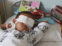 У 6-летнего мальчика неизвестные вырезали глаза