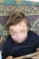 Правоохоронці Тернопільщини затримали чоловіка, який кулаками виховував свого чотирирічного пасинка