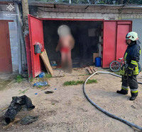 Київська область: внаслідок пожежі в приміщенні гаража травмовано чоловіка та дитину