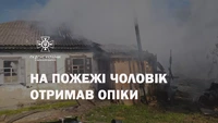 Черкаський район: під час пожежі чоловік отримав опіки