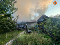 Київська область: під час пожежі власник отримав опіки