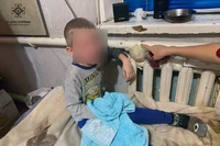 М. Дніпро: рятувальники надали допомогу дитині
