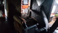 Житомир: під час пожежі в квартирі травмувалося дві людини, одну з них врятував сусід